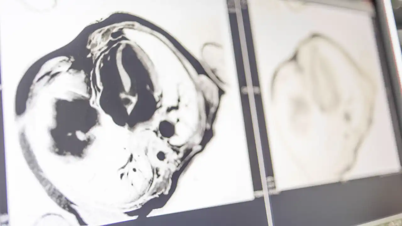 Magnetresonanztomografie