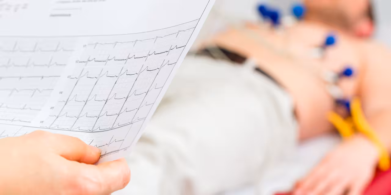 Herz EKG