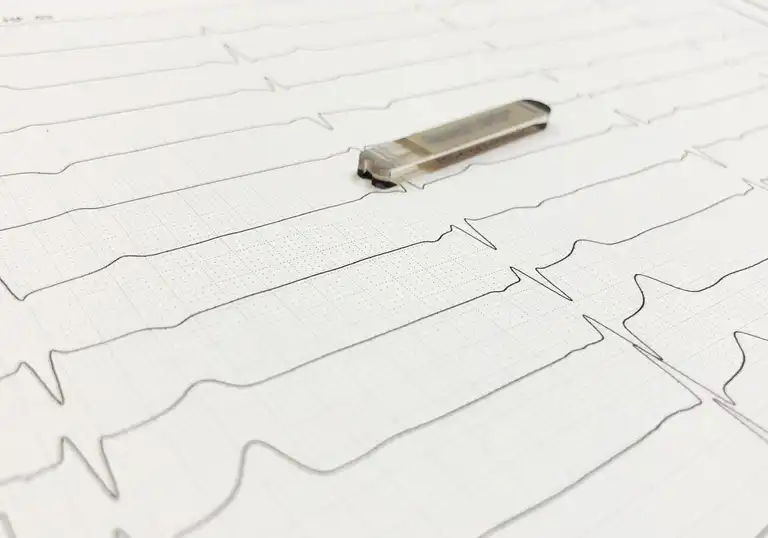 Eventrecorder auf EKG