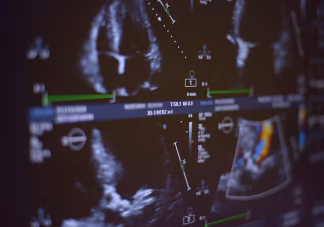 Echokardiogramm auf einem Monitor